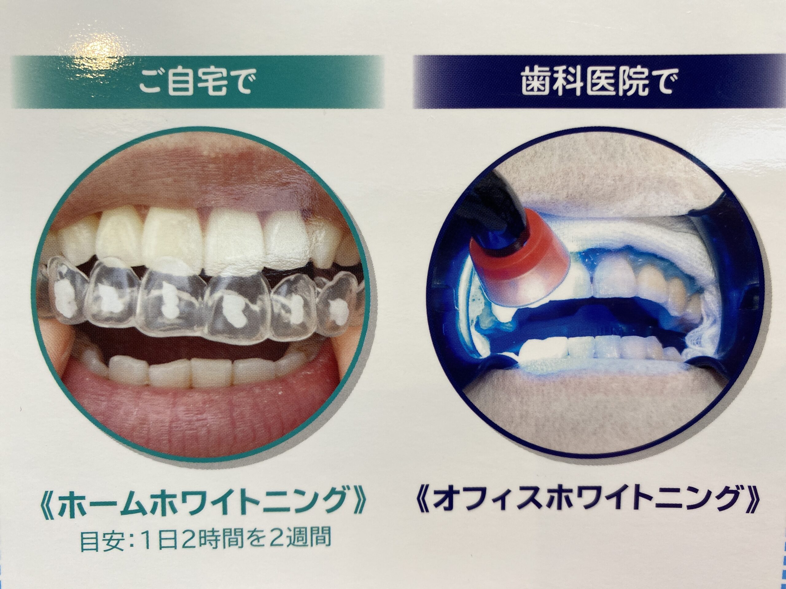 歯のホワイトニング🦷 | 国立の歯医者 土曜日も診療してる国立緑歯科クリニック