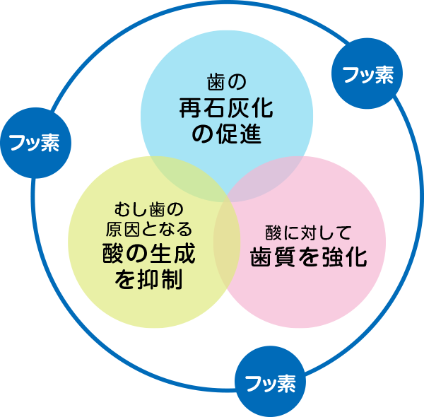 フッ素塗布がむし歯を予防する