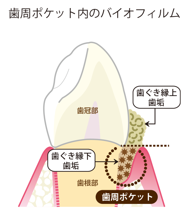 biofilm