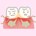 「歯肉炎」「歯周炎」「歯周病」「歯槽膿漏」